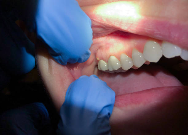 Best Cracked Tooth Emergency Dentist  in Umatilla, OR